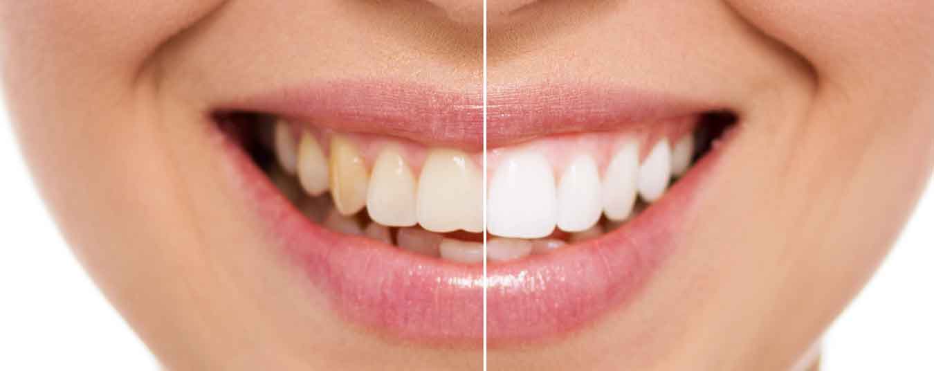 Best pediatric dentist in Nellore: what parents should know before booking